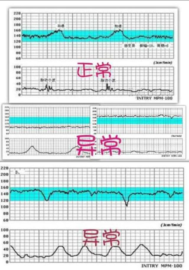 几个月可以测胎心，孕期知识详解