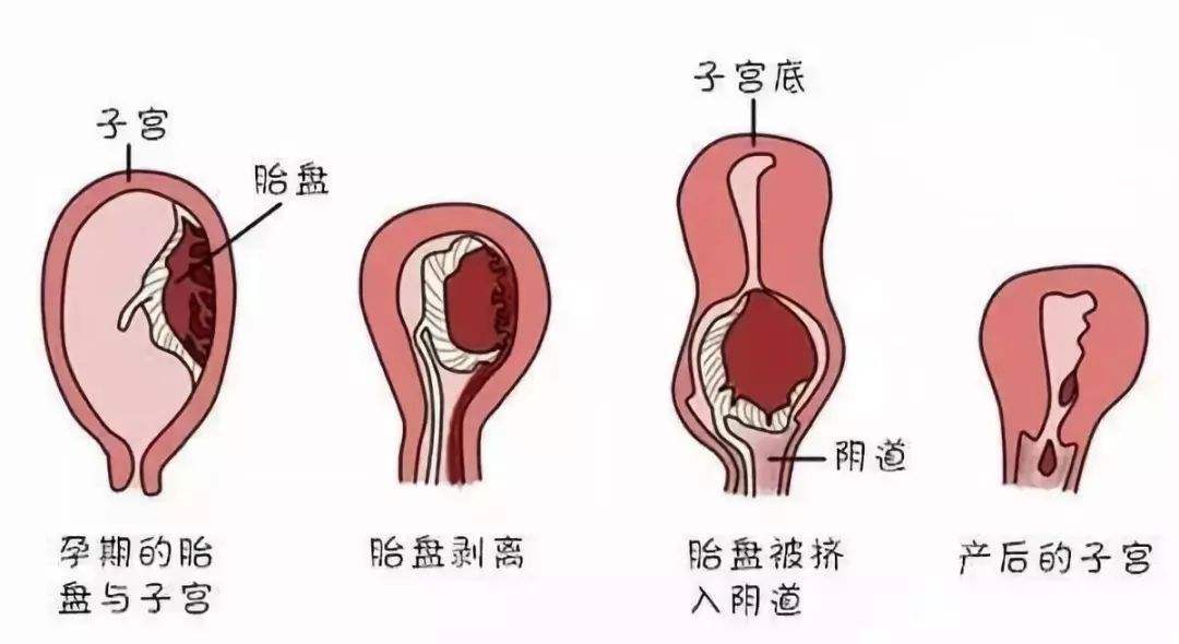 磕伤后硬块持续五个月，原因、处理与预防